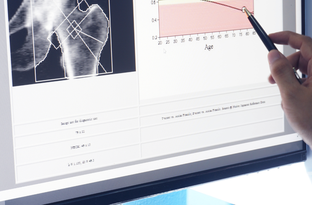Osteoporosis Detection and Prevention